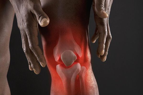 Symptome der Arthrose