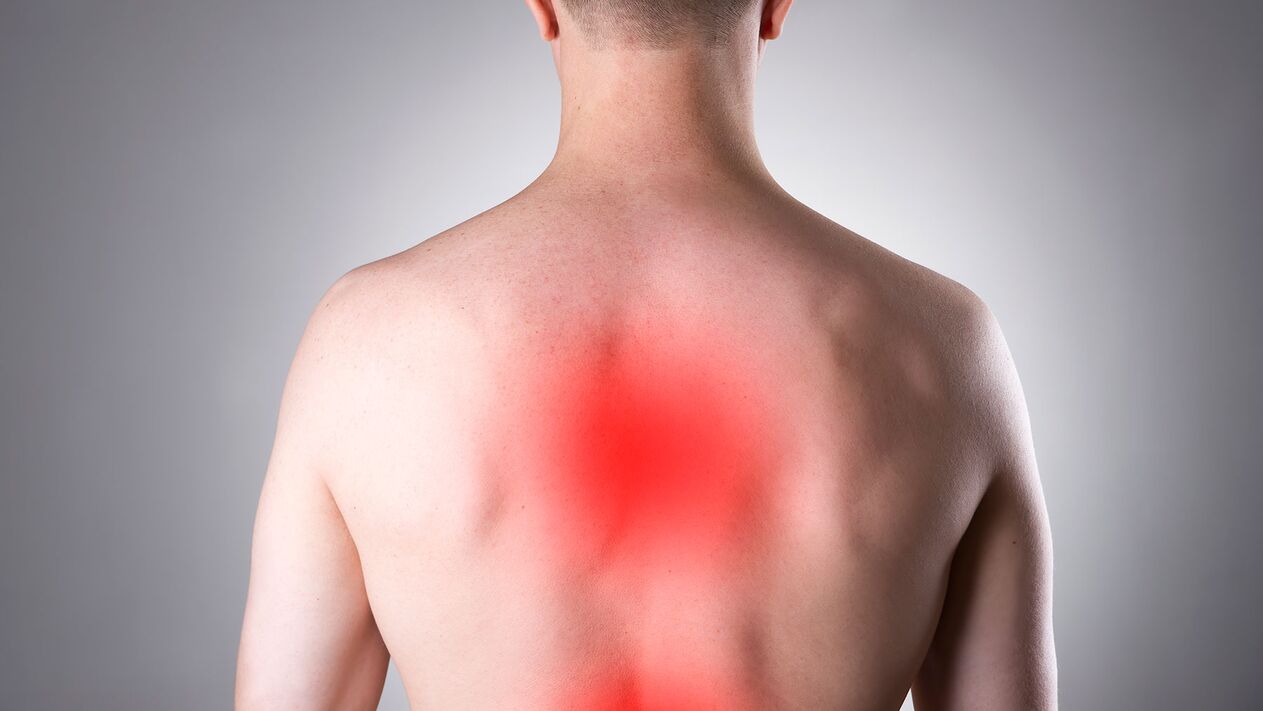 Rückenschmerzen aufgrund von Osteochondrose